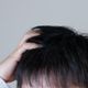 阿伯頭皮痘痘擦藥沒好竟是「胃癌末期」　醫曝「5警訊」！