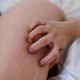 陸5旬女雙腿搔癢2個月難耐…一查竟是「肝癌」嚇傻眼