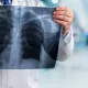 不是感冒！肺腺癌「7大警訊」要當心　醫界籲：免疫治療健保擴大給付