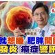 小麥的健康筆記/吃完就想睡？　醫曝「肥胖開關」已悄悄啟動