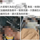 36歲台電員工搶修遭電擊重傷搶救中！父發文盼大家一起集氣