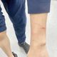 桃園逆子酒後砍父又咬傷員警　4罪名起訴