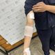 台南所長追行車糾紛嫌犯　竟遭對方持榔頭攻擊、咬傷手臂