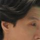 李東健罹罕病！右眼充血、呼吸劇痛折磨全身　每月發作1次