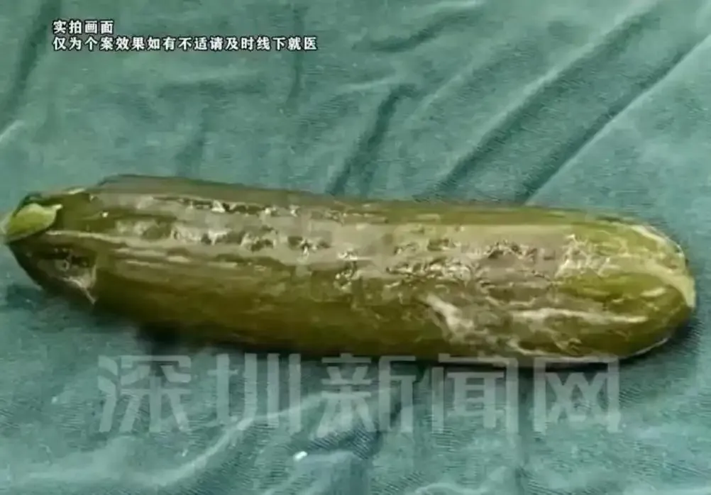 從男子體內取出的黃瓜。（圖／翻攝微博）