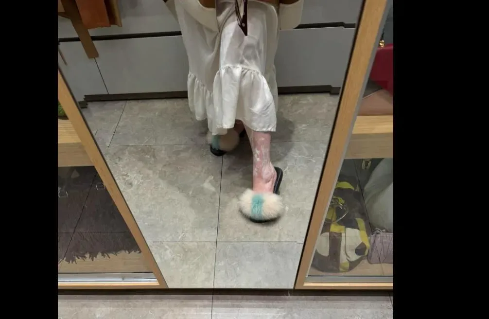 陳文茜還分享出坐在連身鏡前面左腳上塗滿藥膏的模樣。(圖/翻攝自臉書「文茜的世界周報 Sisy's World News17小時 」)
