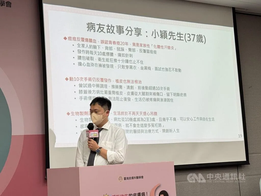 化膿性汗腺炎為自體免疫失調疾病，常會與青春痘混淆，病友小穎（圖）分享經驗，盼鼓勵其他病友不要輕言放棄治療可能。（圖／中央社）