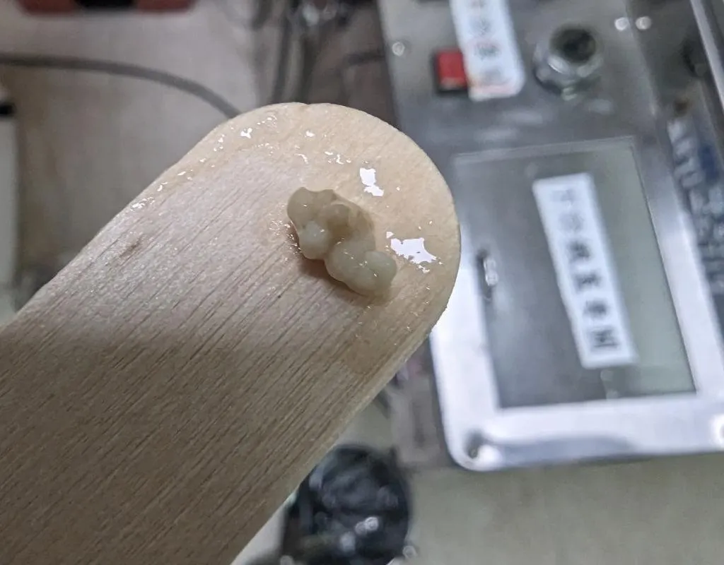 這種如同小米粒般的結石卡在喉嚨深處,除了造成喉嚨卡卡、口腔異味等常見症狀,還可能引發肩頸異常僵硬痠痛。(圖/李晏廷醫師臉書)