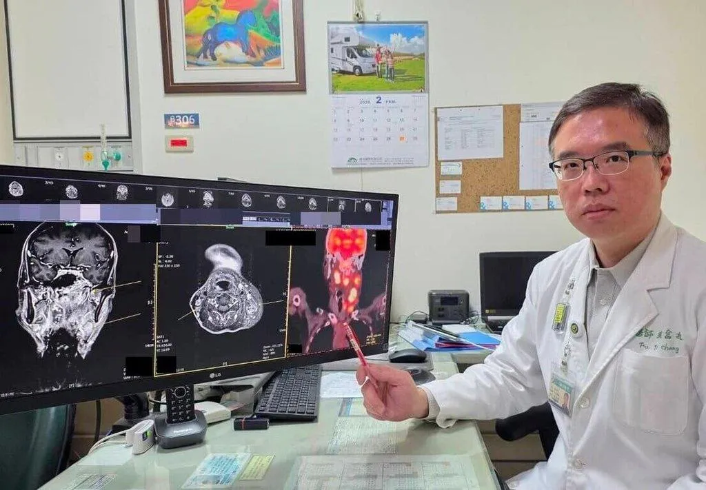 大千醫院放射腫瘤科主任張富迪表示,鼻咽癌在台灣相當常見,持續性耳鳴或頸部腫塊都是警訊。(圖/大千醫院提供)