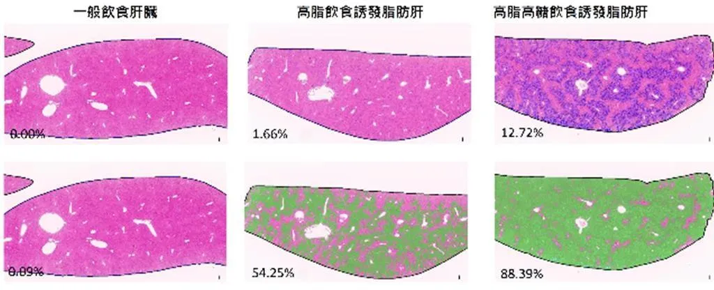 國家實驗研究院國家生物模式中心與成功大學電機工程學系特聘教授跨域詹寶珠合作,發表「AI+MASH病理量化平台」,透過AI影像分析技術,幫助研究團隊快速評估藥物對病變進程的干預效果。(圖/國研院)