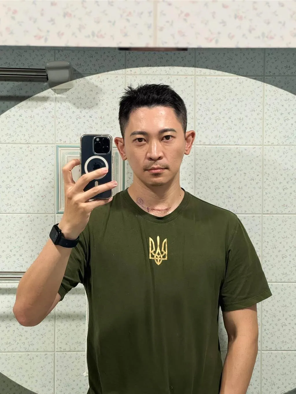 根據王顯瑜的敘述,他在公司例行健康檢查中,透過甲狀腺超音波檢查發現異常結節,隨後追蹤內分泌科時,醫師診斷出這是一顆達3公分大的腫瘤。(圖/翻攝自王顯瑜臉書)