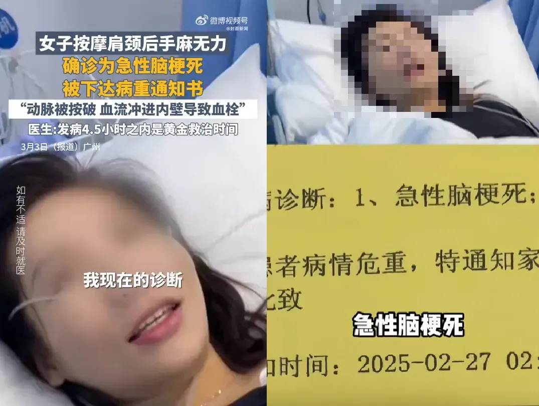 大陸廣東一名女子在2月接受按摩後突發腦梗塞。（圖／翻攝自微博）