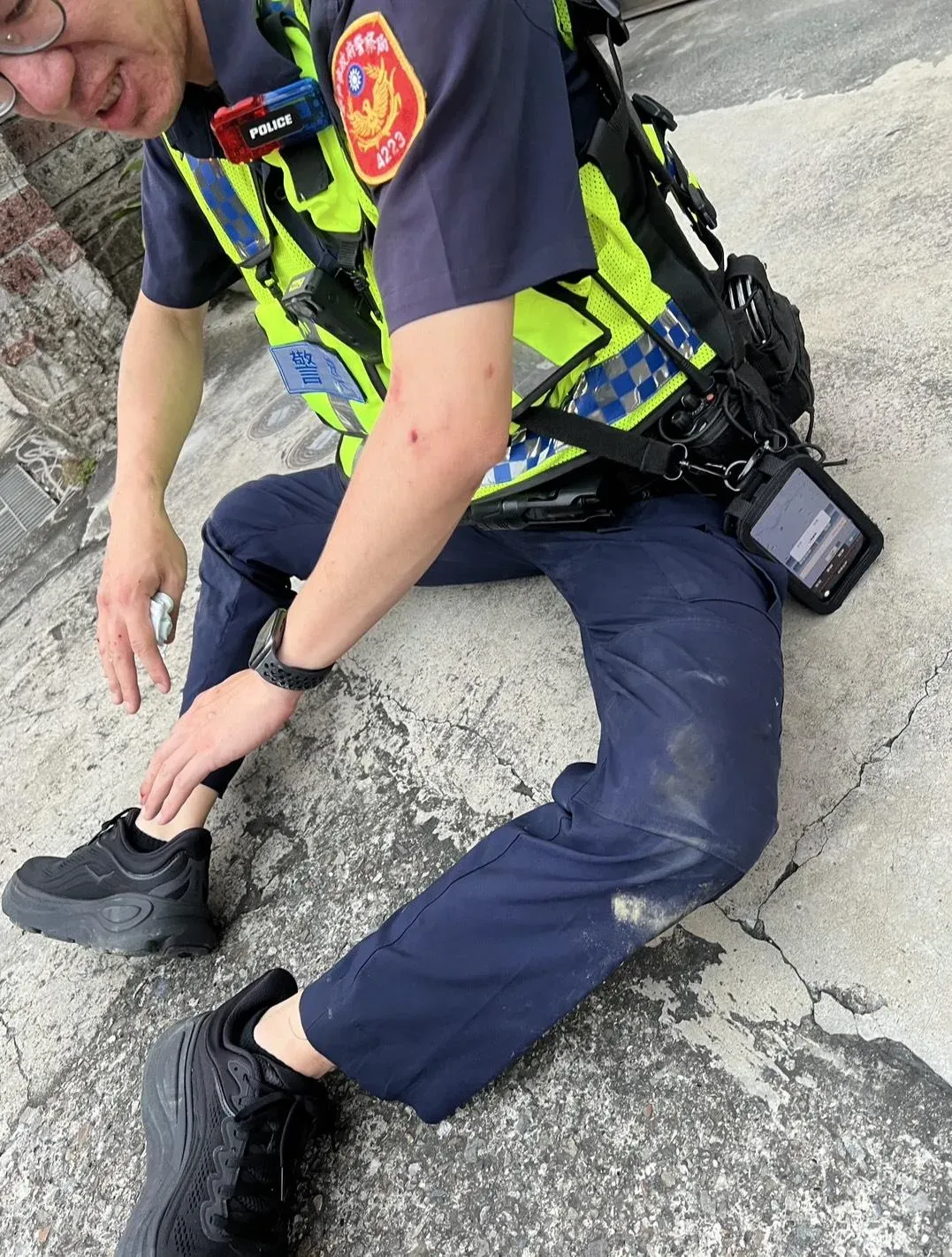 員警四肢擦挫傷。(圖/翻攝畫面)