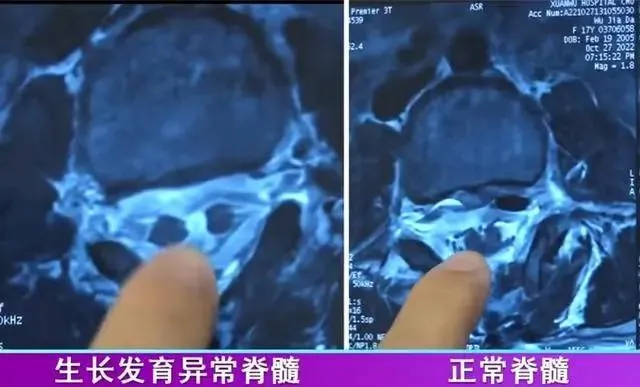 腰毛3.jpg