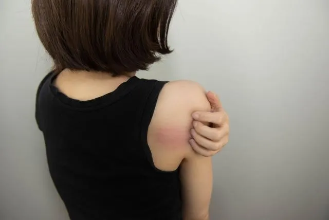 異位性皮膚炎不僅讓許多患者本身困擾不已,連帶也會影響到照顧者!(示意圖/photoAC)