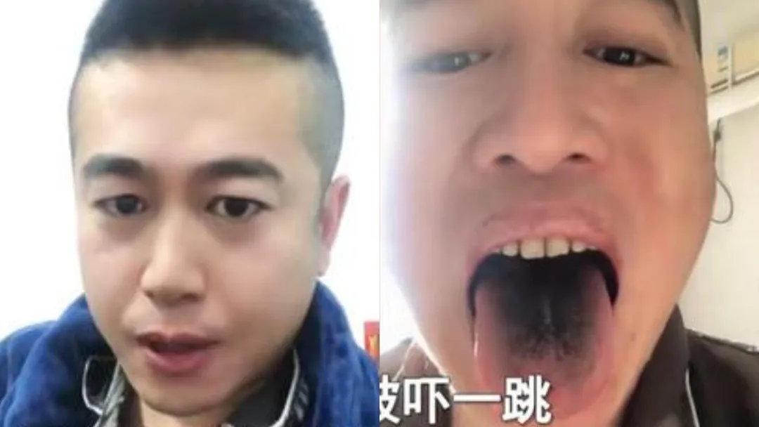 舌黑_秒聞.jpg