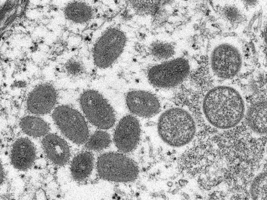疾管署今(16)日公布國內上週(7/9-7/15)新增5例M痘(Mpox)本土確定病例,皆為青壯年男性。(示意圖/photoAC)