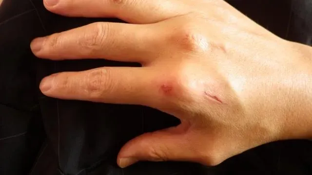 遇到皮膚上有傷口需要擦藥膏時，先不要擦護手霜。（示意圖／資料庫）