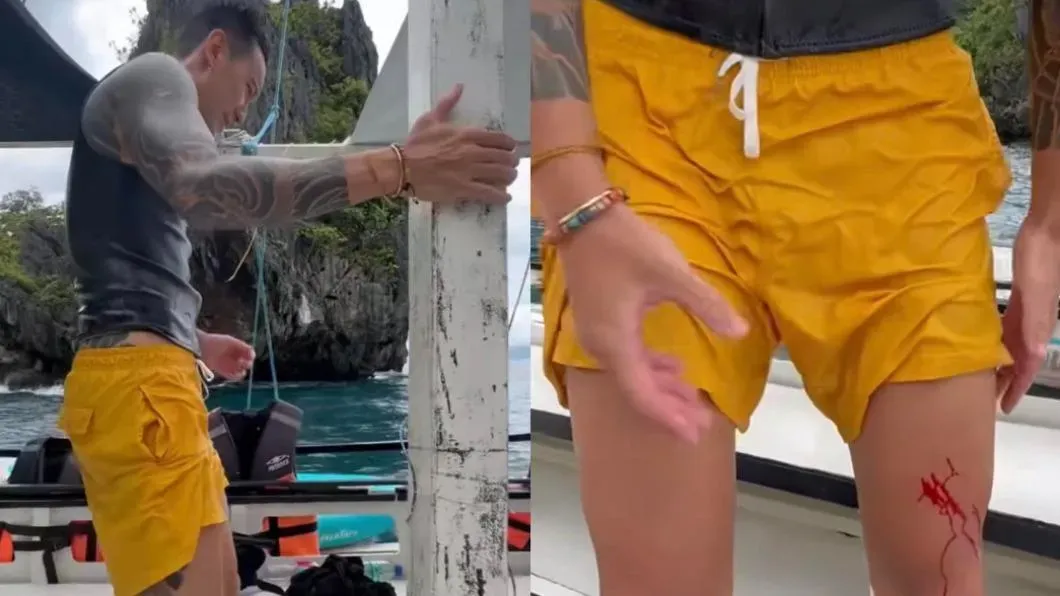 王陽明分享的影片中,他的左大腿因潛水被礁岩割傷,傷口血流如注。(圖/翻攝自Instagram@sunnyboyyy)