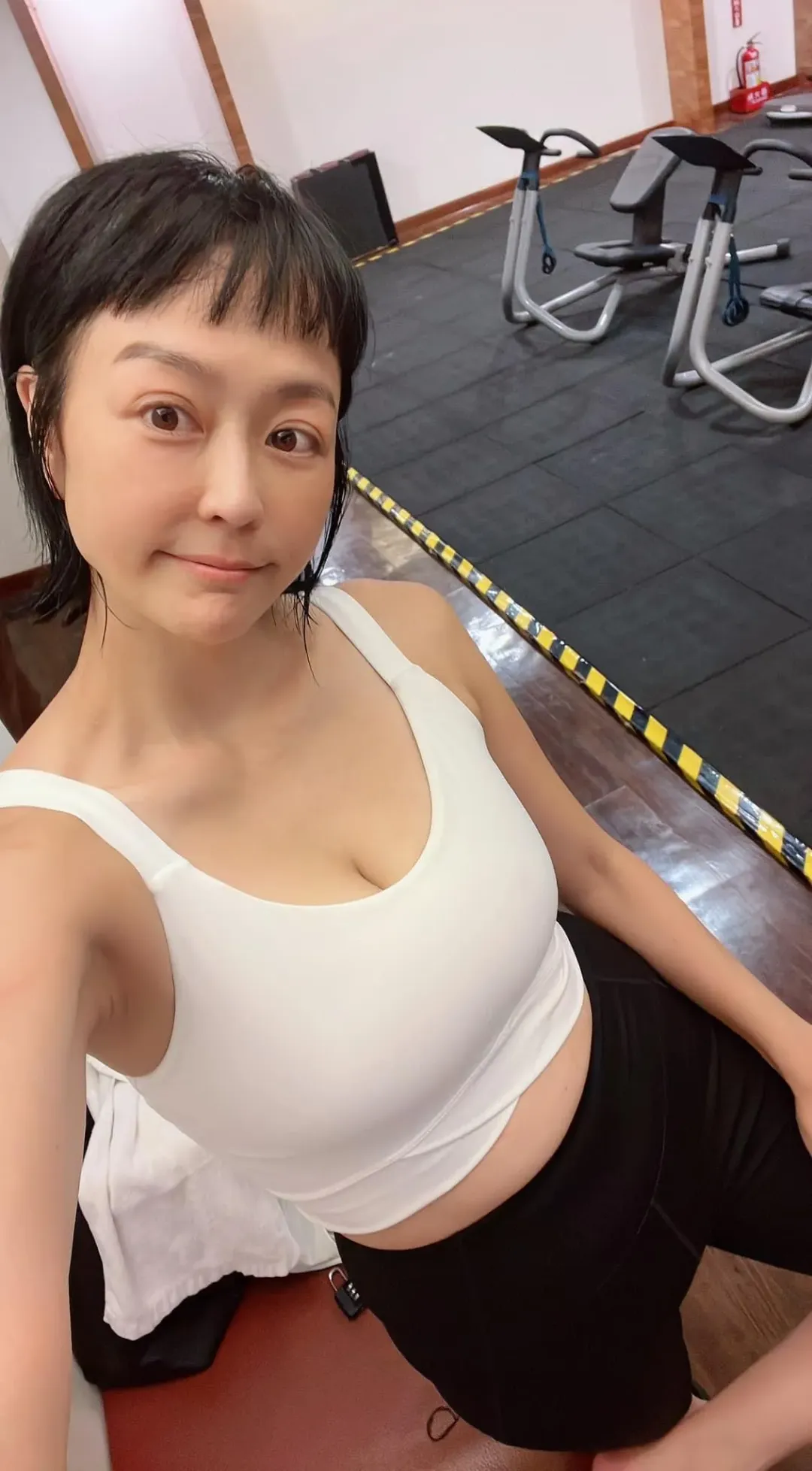 因做許多次化療,讓唐玲出現取多神經病變問題。