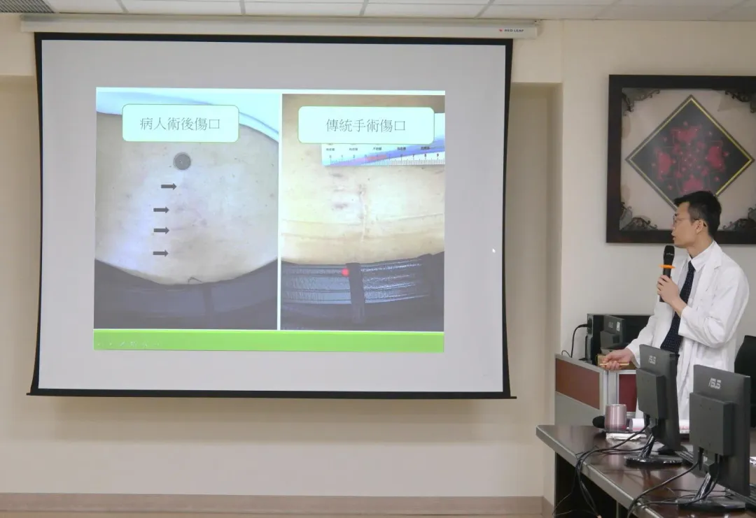 李威佑醫師指出,內視鏡減壓手術的優點就是微創、減少組織破壞、保留腰椎柔軟度等。(圖/安南醫院提供)
