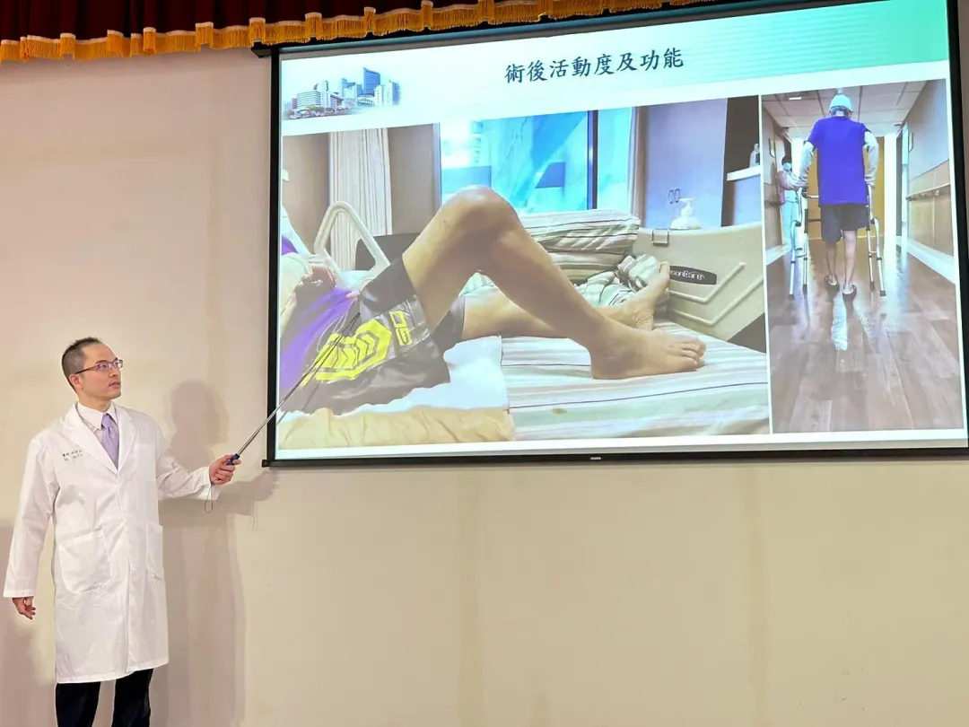 林宗立醫師說明江伯伯置換3D列印活動骨水泥後，膝蓋可以自由彎曲0~90°，且正常行走。（圖／中國醫藥大學附設醫院提供）