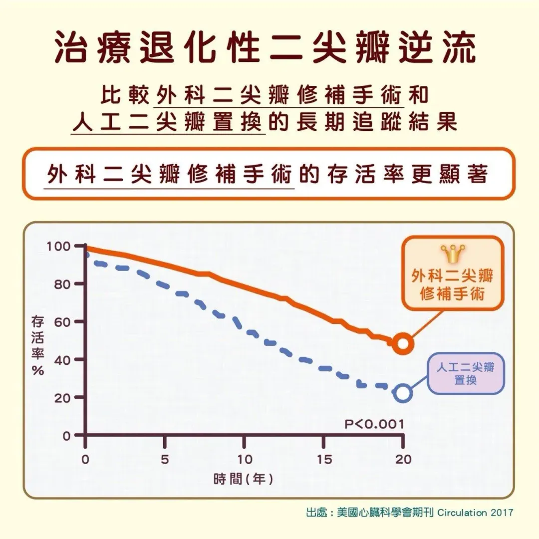 退化性二尖瓣逆流以手術修補的治療，病人的長期存活率較瓣膜置換更佳。（圖／林口長庚醫院提供)