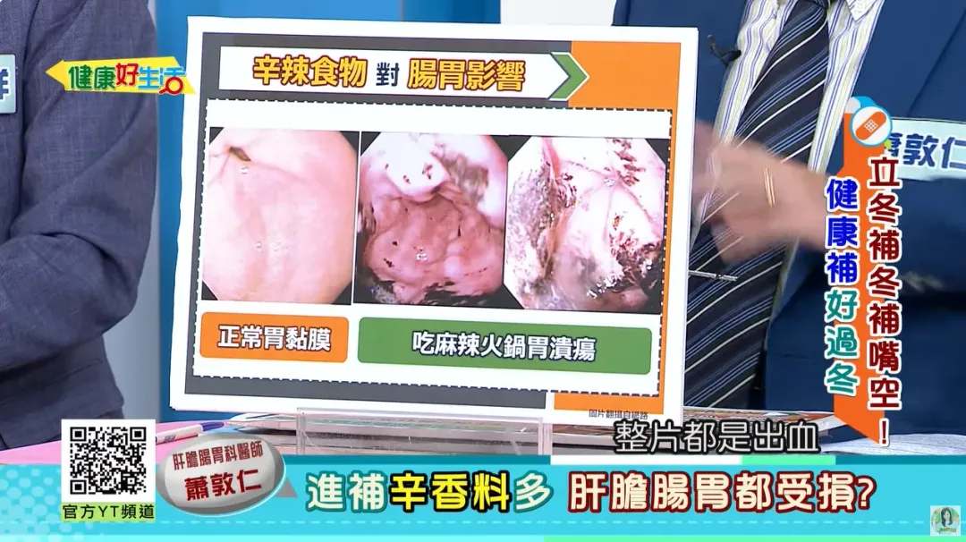 照胃鏡後,發現病人的胃「整片出血」。(圖/《健康好生活》)