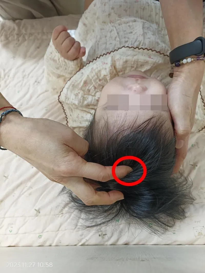 小朋友若發燒無異狀還要注意到囟門有無凸起。（示意圖／林新醫院提供）