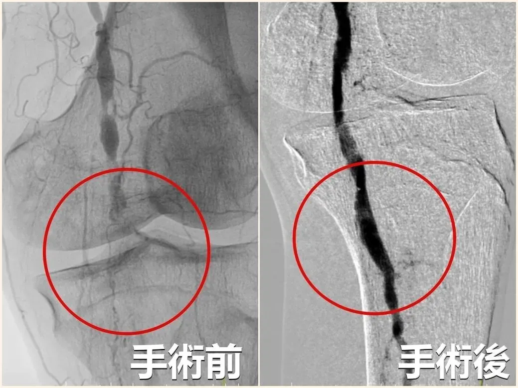 手術前後對比圖。（圖／亞大醫院提供）