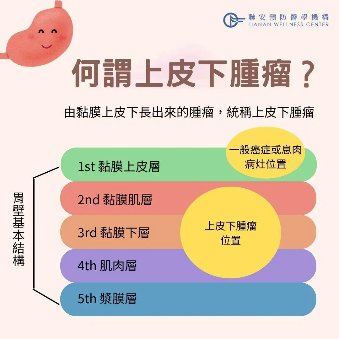 胃壁分五層，非黏膜上皮層長出來的，即為上皮下腫瘤。（圖／聯安預防醫學機構提供）
