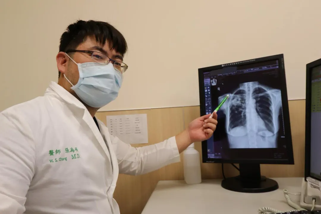 張為碩醫師提醒民眾若有疾病導致免疫力下滑,同時出現久咳問題,就得當心可能是隱球菌症作祟。(圖/亞大醫院提供)