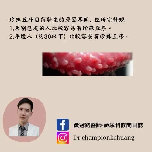 為什麼會有珍珠丘疹?(圖/黃冠鈞醫師臉書)