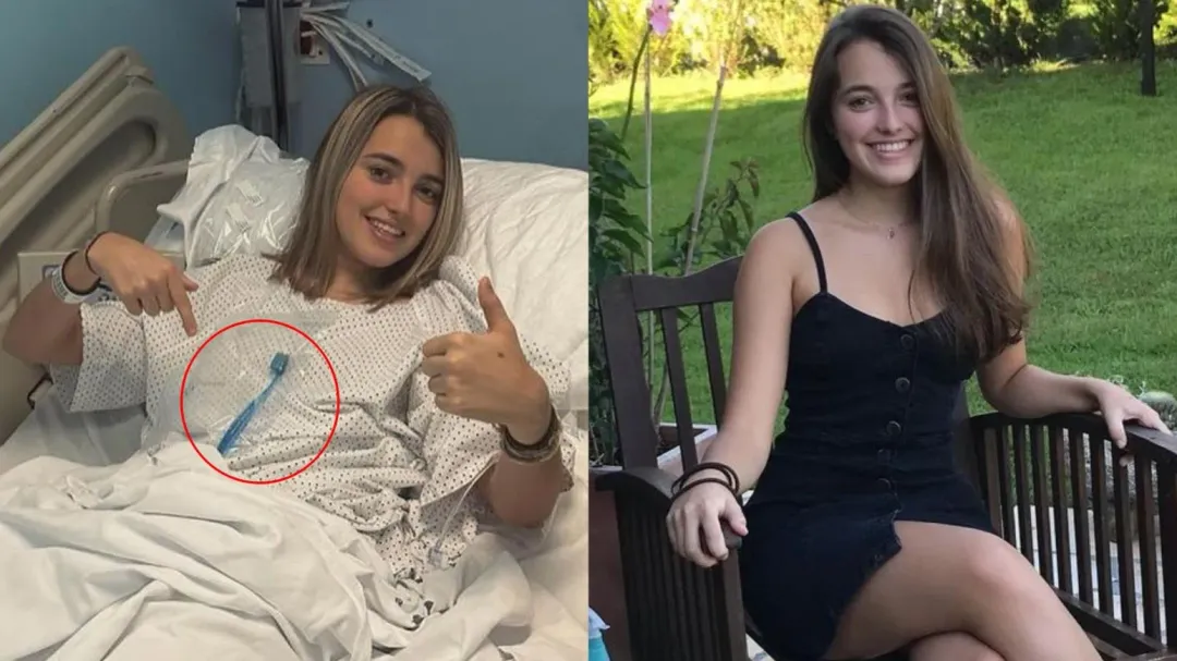 21歲的海澤被食物噎住, 竟用牙刷去撈, 結果整支吞下肚。(圖/翻攝IG「haaiizzee」)