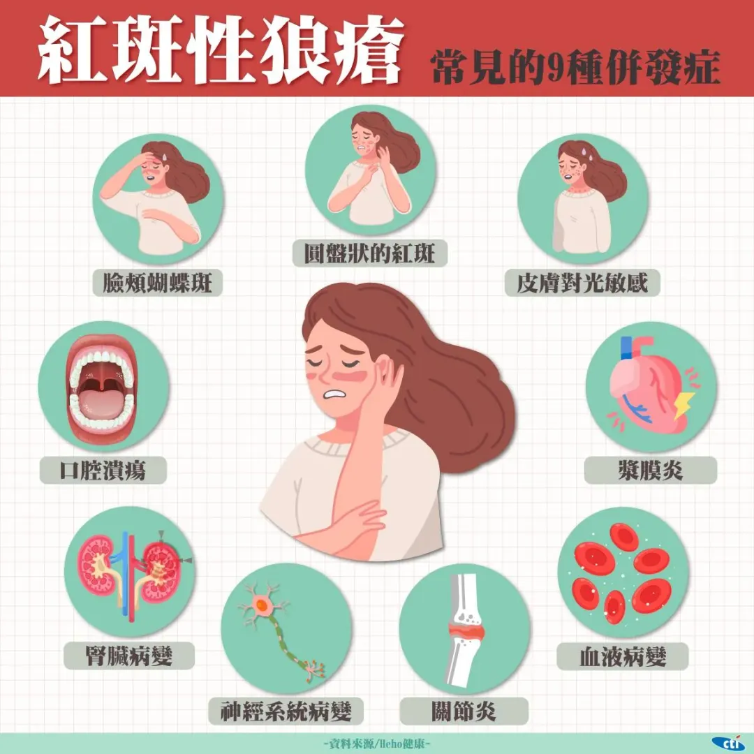 紅斑性狼瘡常見症狀。(圖/中天製圖,下同)