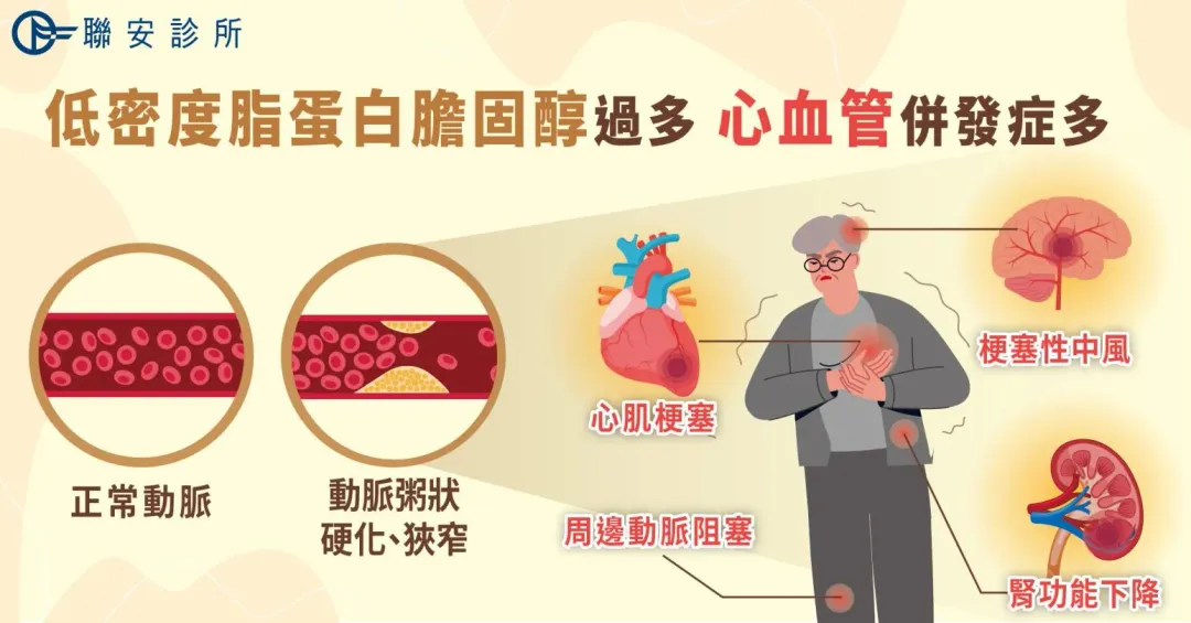 怕心血管風險高？改善膽固醇質與量都很重要。（圖／聯安預防醫學機構提供）