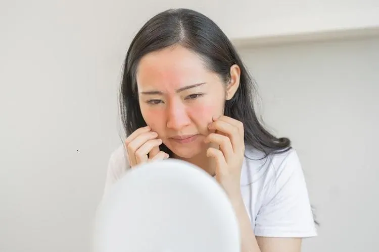 蝴蝶病「紅斑性狼瘡」 免疫異常攻擊正常組織。(圖/資料庫)