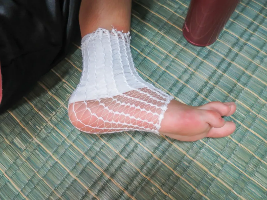 妥善急救+積極復健 恢復正常行走。(圖/photoac)