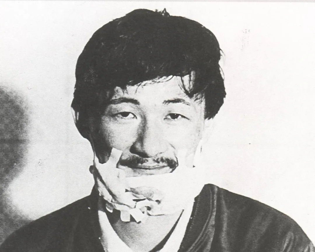 施明德因「美麗島事件」逃亡遭逮捕時拍下的照片裡,臉部有大量紗布。(翻攝施明德臉書)