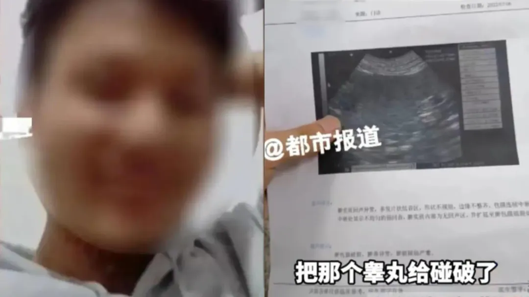 張蒙(化名)騙父親自己騎車不慎把睪丸弄破,急需百萬元醫藥費,還偽造超音波及診斷書。(圖/翻攝微博)