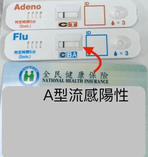 10歲童確診A型流感,服用克流感藥物後,原以為症狀緩解。(圖/張弘醫師臉書)