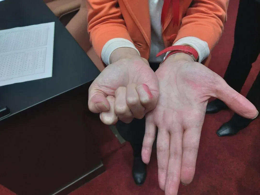 陳昭姿因小指沾染印泥導致院長選舉出現無效票(攝自陳昭姿臉書)