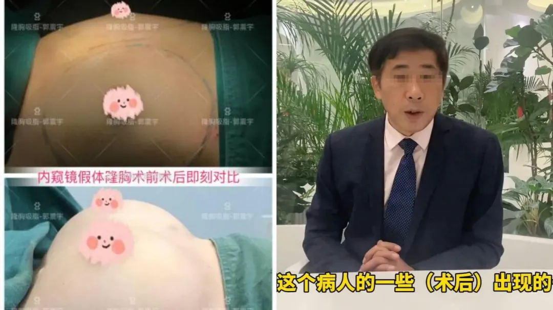 涉事醫生郭震宇經常在微博上傳手術前後照片或影片。（圖／翻攝微博）