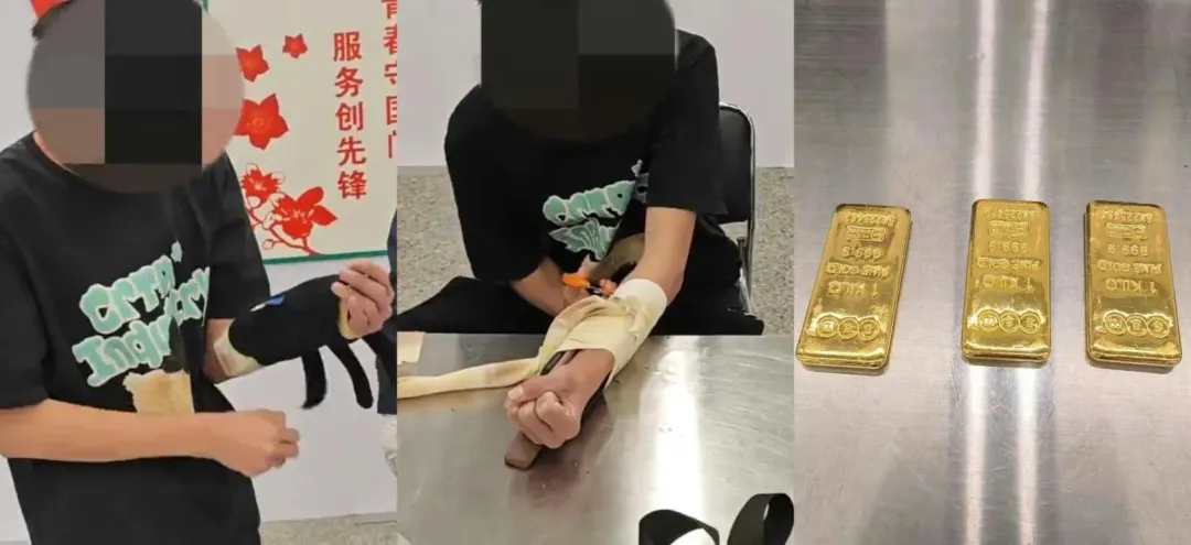 港男入境深圳時,被抓包繃帶裡藏了價值570萬的金條企圖走私。(圖/翻攝大陸海關)