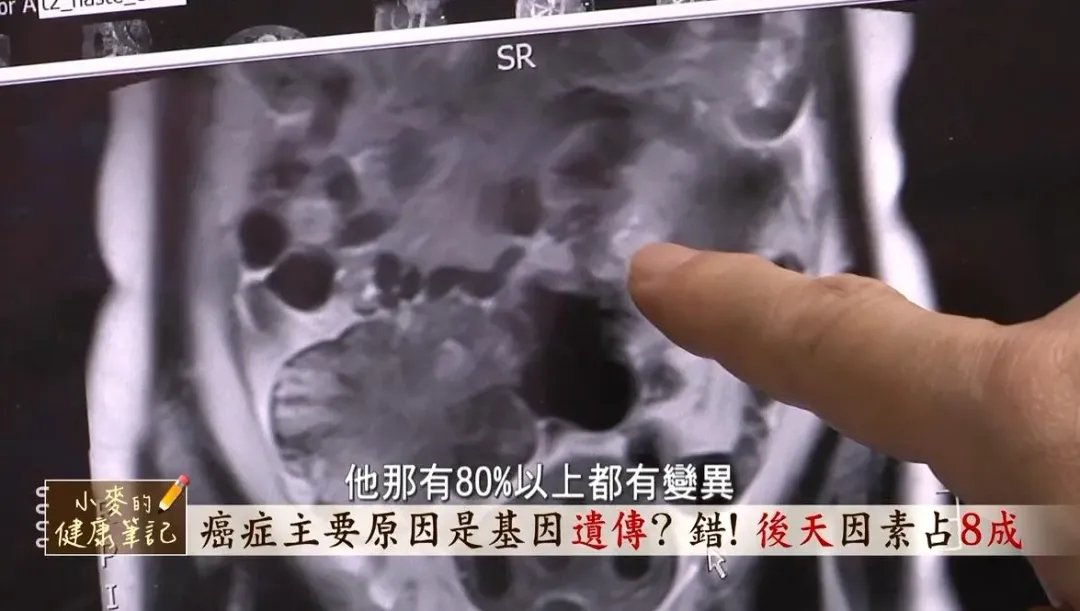 名醫季匡華公開「8＋9」預防癌症關鍵， 秘訣就在激活副交感神經系統活動。（圖／《小麥的健康筆記》提供）