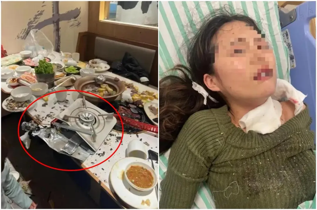 卡式瓦斯爐爆炸後扭曲變形(圖左),而被波及的壽星(圖右)臉部燒傷,視力受損。(圖/翻攝微博)