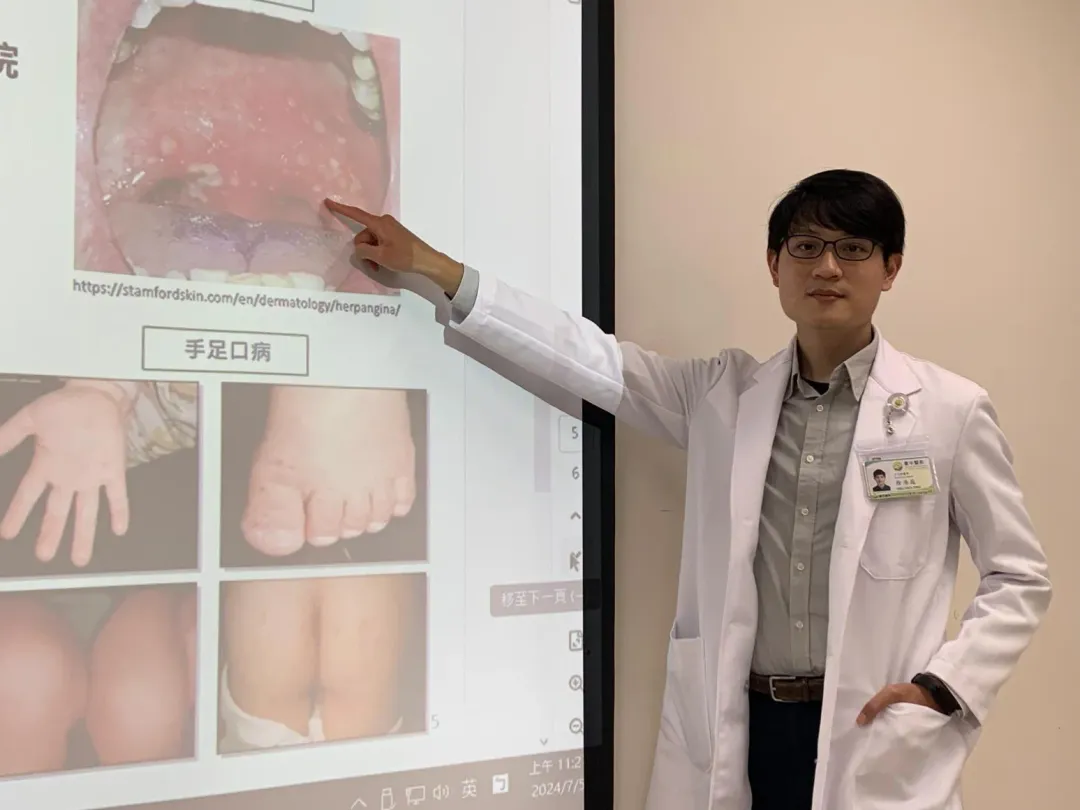 臺中醫院兒童感染科醫師徐浩庭。（圖／衛福部台中醫院提供）