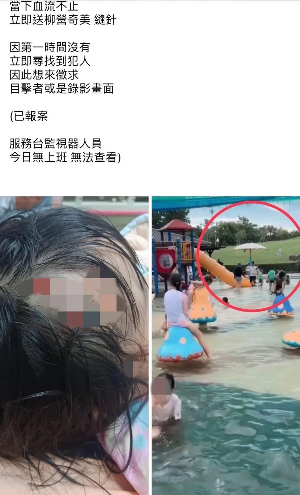 遊客昨(13日)在臉書社團「台南大小事」中發文,表示友人的女兒在烏山頭親水公園玩水時,遭一名男童用水槍砸破頭,希望網友協尋兇手。(圖/翻攝自臉書社團台南大小事)