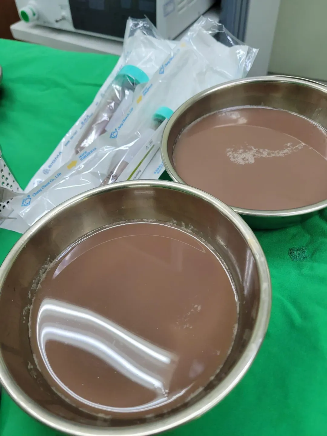 男子被引流出左腎積存的尿液,色澤有如奶茶色,裝了兩大盆。(圖/黃維倫醫師臉書粉專)