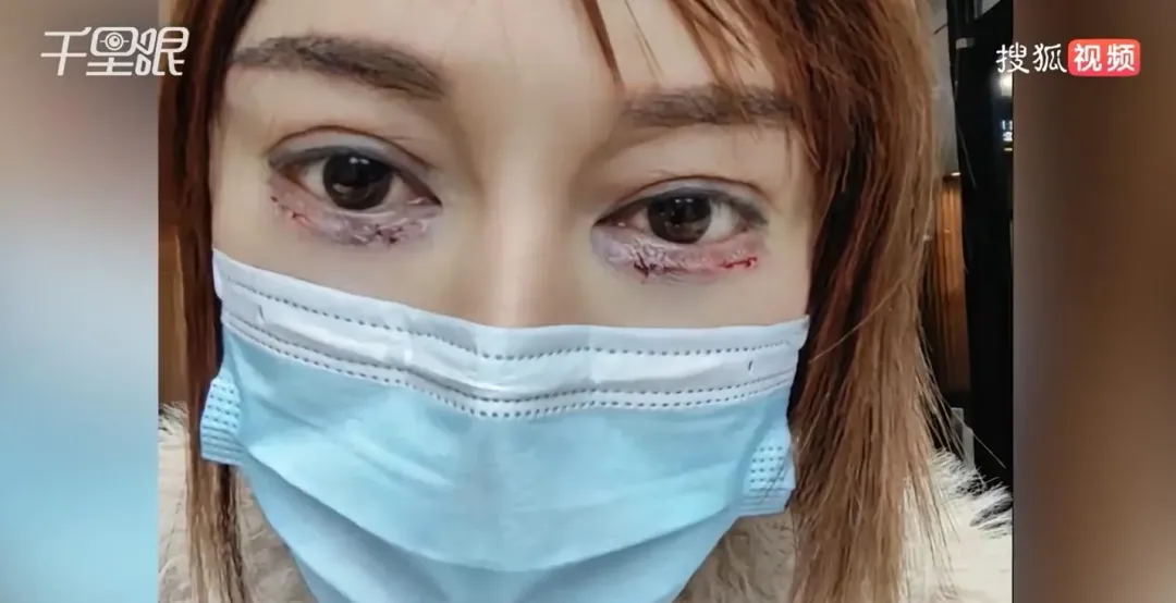 張女表示與涉事整形醫院協商迄今未果。（圖／翻攝搜狐千里眼）
